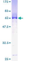 Human MBNL1 / MBNL Protein (Recombinant GST)