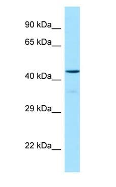 OX1R / Orexin Receptor 1 Antibody (aa263-312)