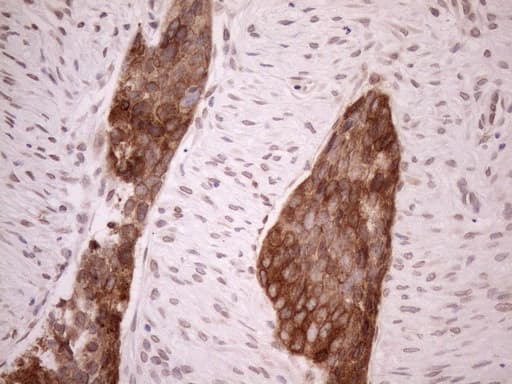 Monoclonal Mouse anti-Human AAAS / Adracalin Antibody (clone OTI5B10, aa322-546, IHC, WB)