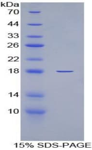 Mouse IL6R / IL6 Receptor Protein (Recombinant His)