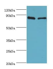 Polyclonal Rabbit anti-Human SLC39A6 / LIV-1 Antibody (aa170-320, IHC, WB)