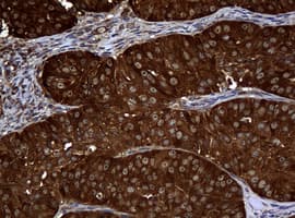 NME1 / NM23 Antibody (clone OTI4H2)