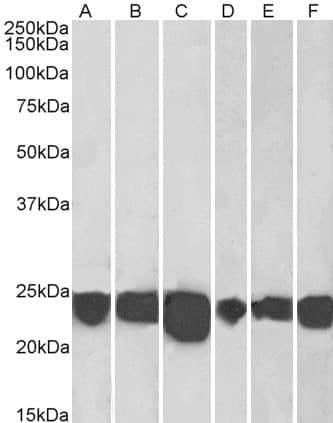 IHC-plus™ PARK7 / DJ-1 Antibody (aa178-189)