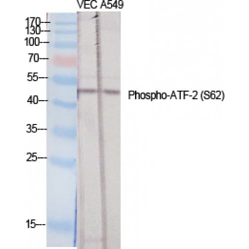 Polyclonal Rabbit anti-Human ATF2 Antibody (40-120 aa, IHC, WB)