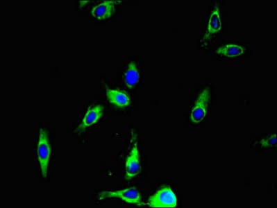 Polyclonal Rabbit anti-Human ANO4 Antibody