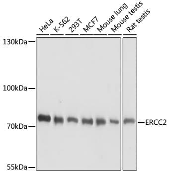 Polyclonal Rabbit anti-Human ERCC2 / XPD Antibody (WB)