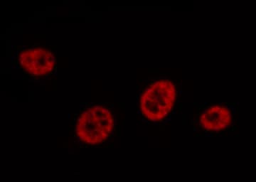 AML1 / RUNX1 Antibody (phospho-Ser303)