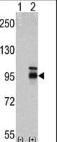 IHC-plus™ FGFR4 Antibody (clone 53CT32.19.3)