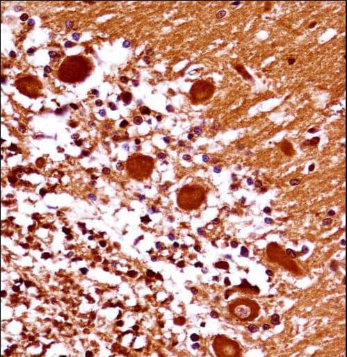 MEOX1 Antibody (aa136-165)