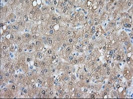 Monoclonal Mouse anti-Human ACAT2 Antibody (clone OTI1G6, IHC, IF, WB)
