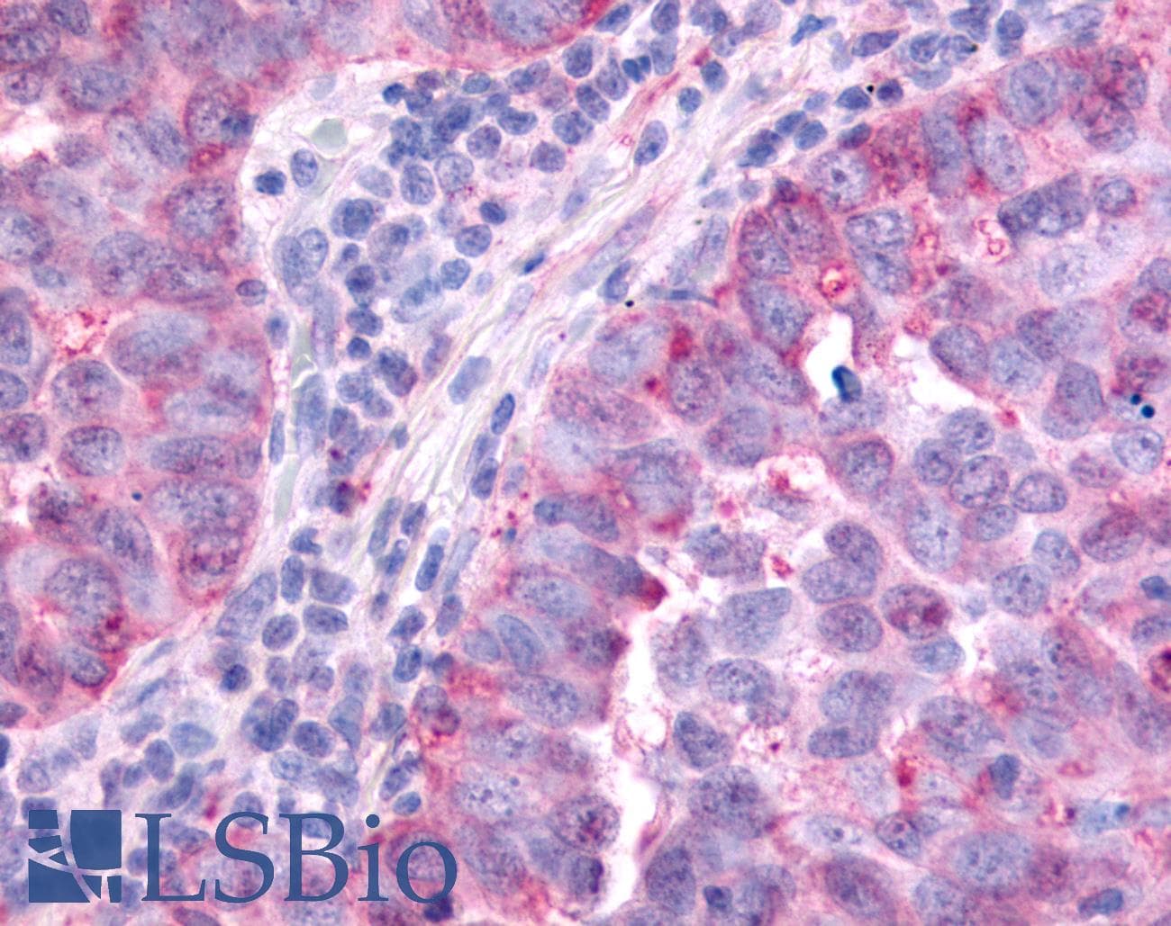 PathPlus™ PAK6 Antibody (Linker Domain)