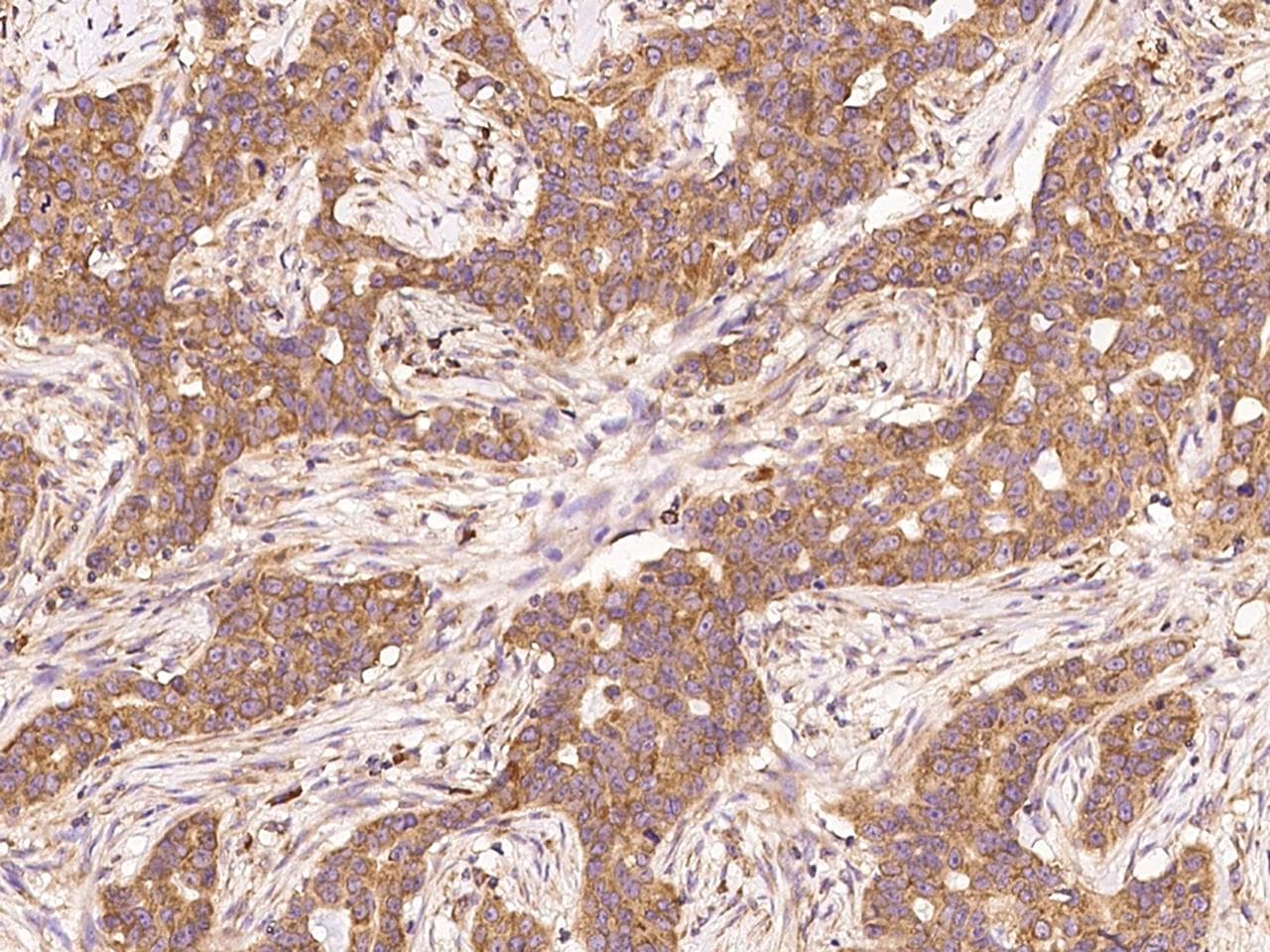 EEF1A1 Antibody