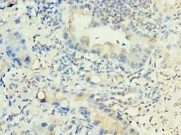 LRG1 / LRG Antibody (aa36-347)