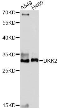 Polyclonal Rabbit anti-Human DKK2 Antibody (WB)