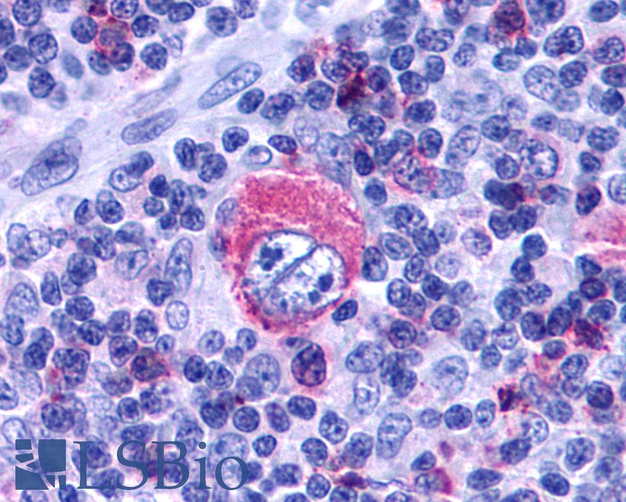 PathPlus™ LTB4R2 / BLT2 Antibody (Cytoplasmic Domain)