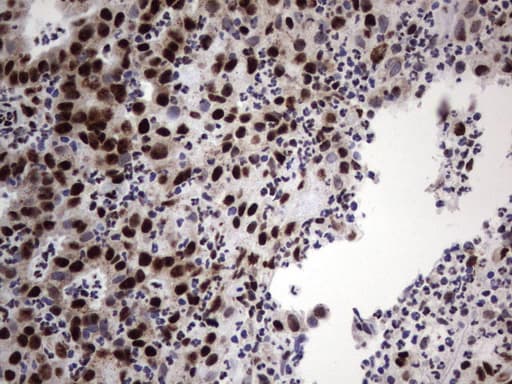 DDX56 Antibody (aa323-547, clone UMAB152)