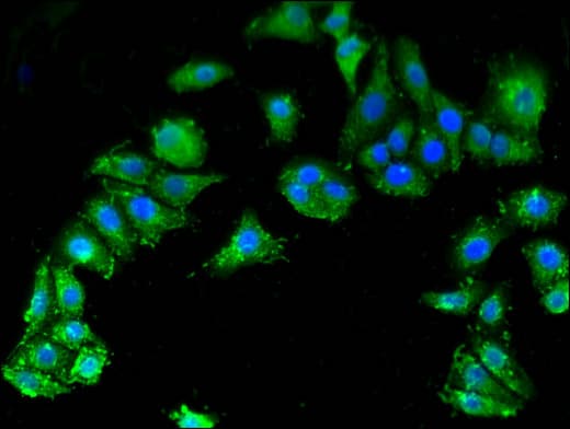 SMN1 Antibody
