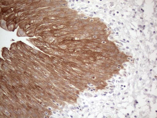 CAMK2B / CaMKII Beta Antibody (aa311-385, clone OTI8D9)