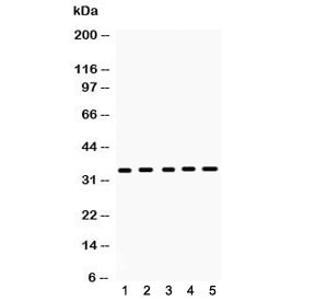 CCS Antibody