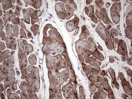 Adiponectin Antibody (aa19-244, clone OTI1F11)