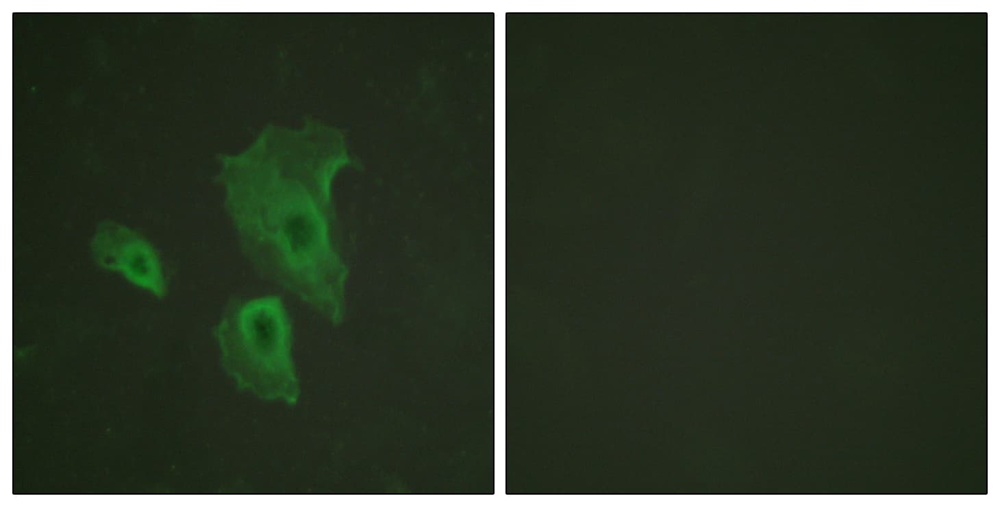 BCL2 / Bcl-2 Antibody (phospho-Thr69)