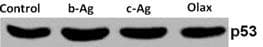TP53 / p53 Antibody