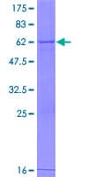 Human GDPD1 Protein (Recombinant GST)