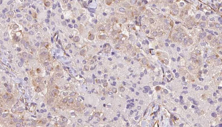 TRIM14 Antibody