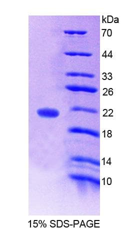 Human WTAP Protein (Recombinant His-T7)