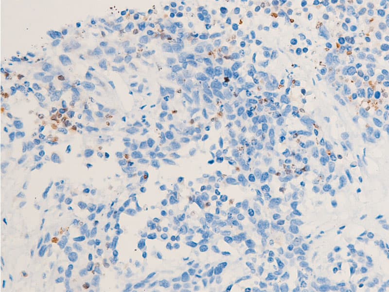 CHEK1 / CHK1 Antibody (phospho-Ser286)