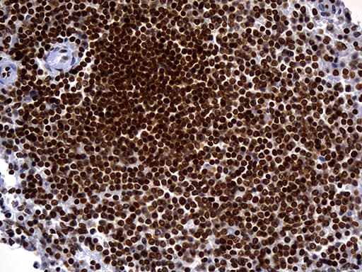 Monoclonal Mouse anti-Human ALOX5 / 5-LOX Antibody (clone OTI1A1, Carrier-free, aa18-364, IHC, WB)