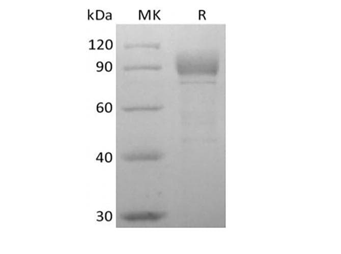 Human OTOL1 Protein (Recombinant 6His, C-terminus)