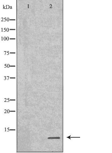 SPINK1 Antibody