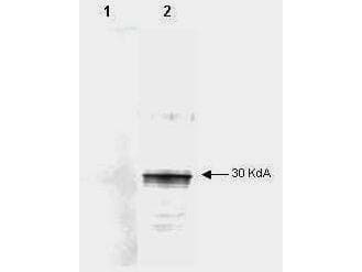 IHC-plus™ TGFB4 / LEFTY2 Antibody (clone 7C5G1H6H10)