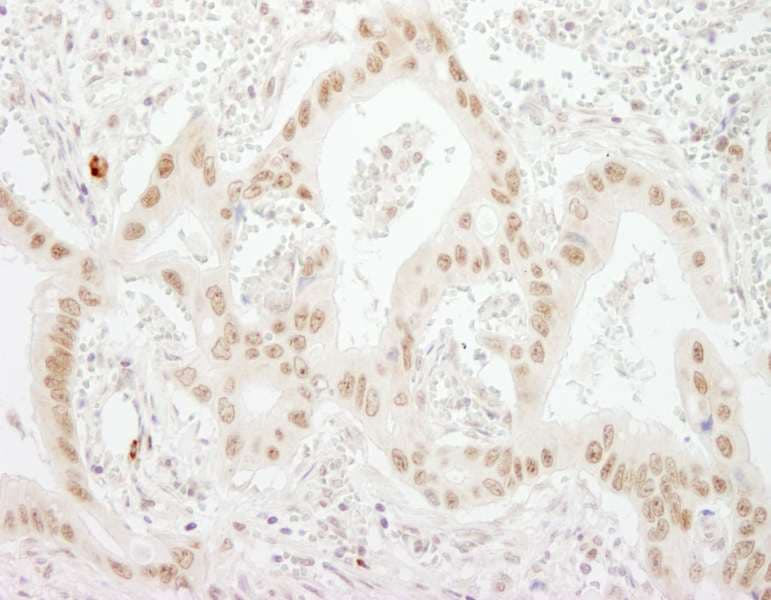 SKIV2L2 Antibody (aa100-150)