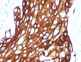 Acidic Cytokeratin Antibody (clone RMAK1-1)