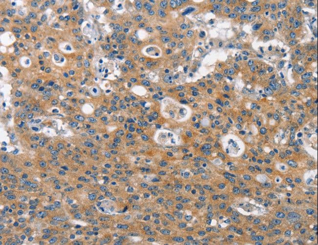 IHC-plus™ Polyclonal Rabbit anti-Human CLTC / Clathrin Heavy Chain Antibody (IHC, WB)
