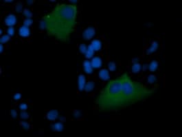 IHC-plus™ Monoclonal Mouse anti-Human MDM4 / MDMX Antibody (clone 3B9, IHC, IF, WB)