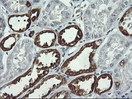 PFKP Antibody (clone OTI2F2, Carrier-free)