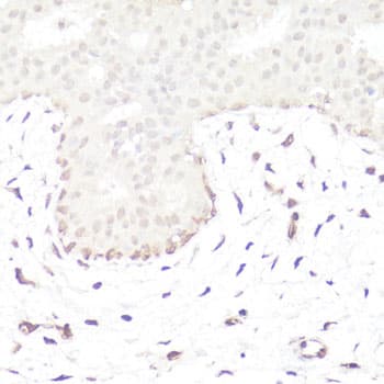 GLI / GLI1 Antibody