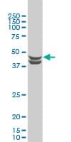 Monoclonal Mouse anti-Human CSNK2A1 Antibody (clone 3D9, IF, WB)