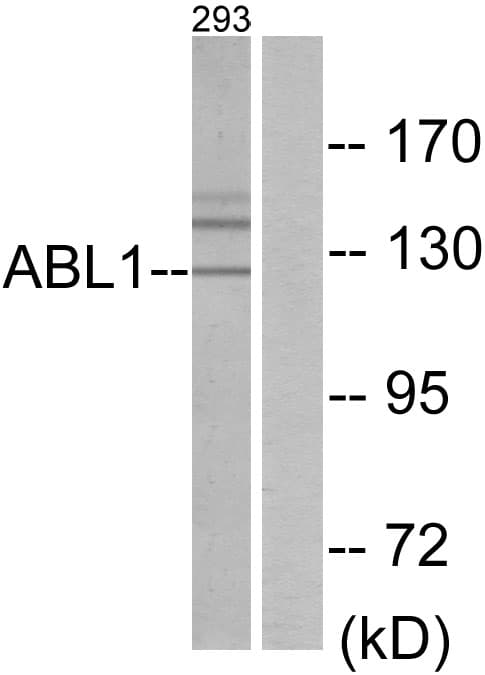 ABL1 / c-ABL Antibody (aa861-910)