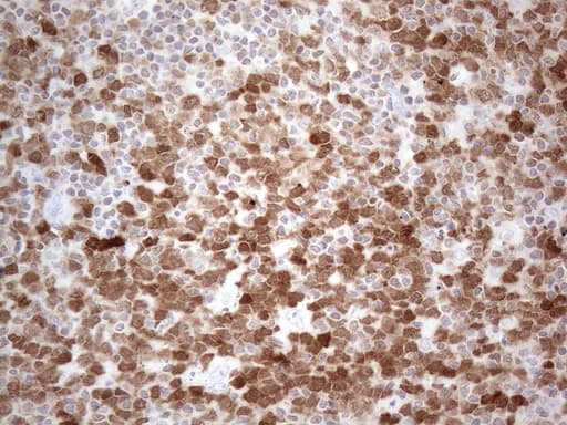 Monoclonal Mouse anti-Human POU2AF1 / BOB1 Antibody (clone OTI2D4, IHC, WB)