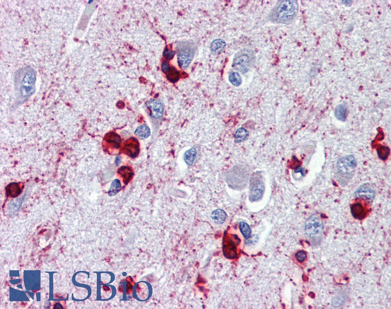 IHC-plus™ CRYAB / Alpha B Crystallin Antibody