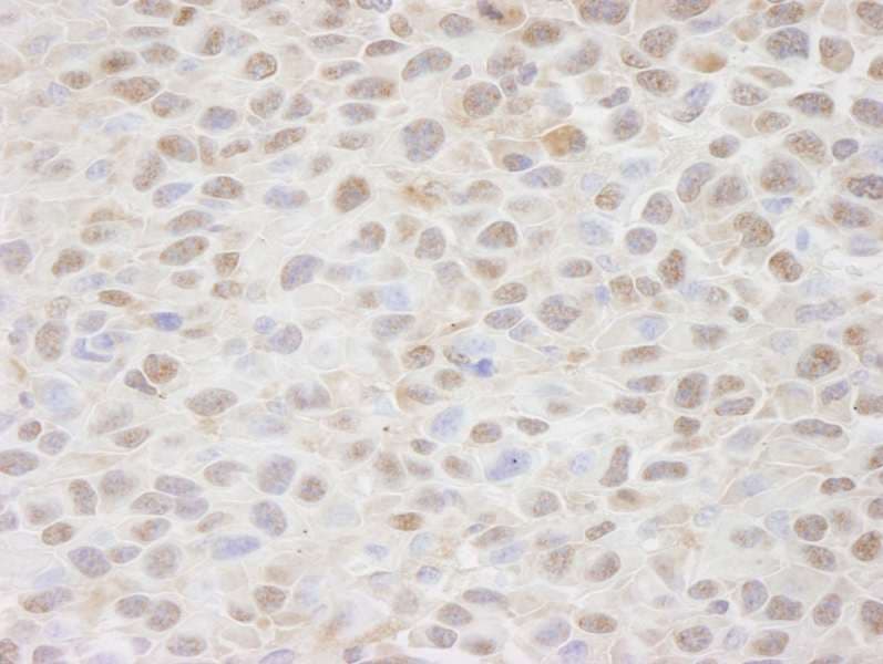 CSE1L Antibody (aa1-50)