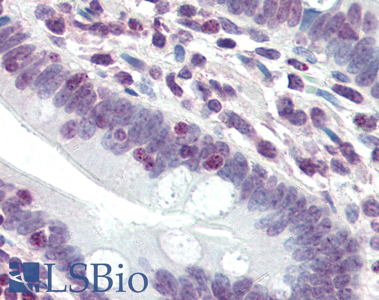 IHC-plus™ DDX3 / DDX3X Antibody (N-Terminus)
