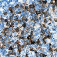 Polyclonal Rabbit anti-Human CDKL3 Antibody (Internal, IHC, WB)