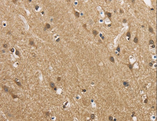 GAS7 Antibody