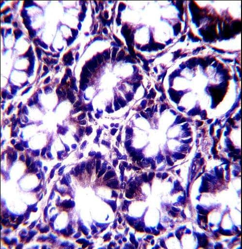 Polyclonal Rabbit anti-Human PALD1 / Paladin 1 Antibody (aa810-839, IHC, WB)