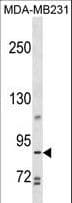 Polyclonal Rabbit anti-Human TROAP Antibody (aa6-33, WB)